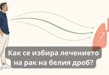 Как се избира лечението на рак на белия дроб?